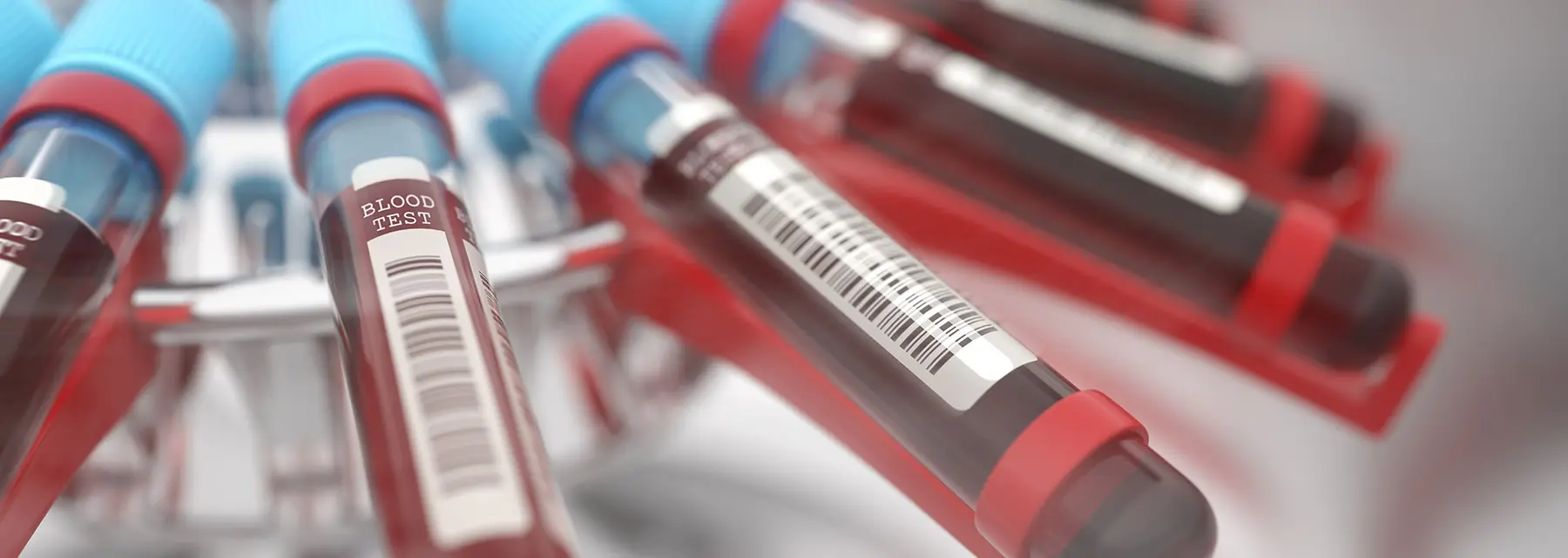Tipos de análisis de sangre: ¿cuáles hay?