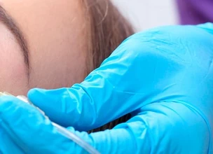 Fillers: ¿qué son?